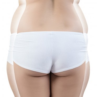 Abdominoplastie