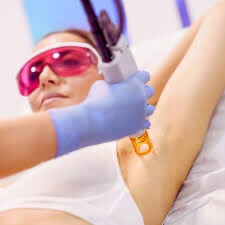 épilation définitive laser femme aisselles